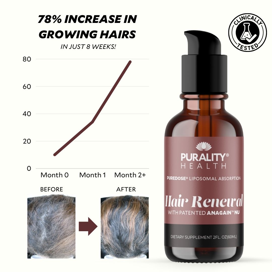 Buy Liposomal Hair Renewal Natural Hair Regrowth Spray with Biotin and Keratin